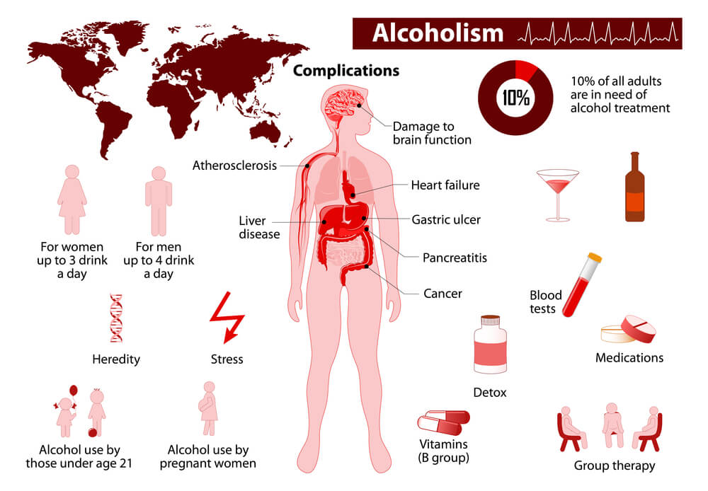 Alcohol Detoxification